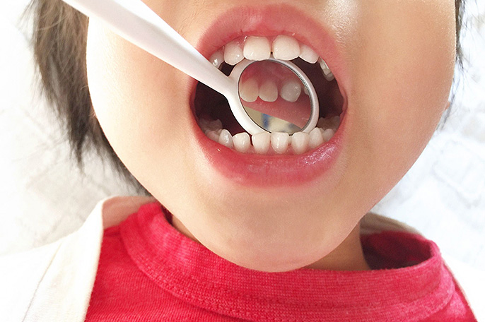 お子さんの年齢に合わせた最適な治療