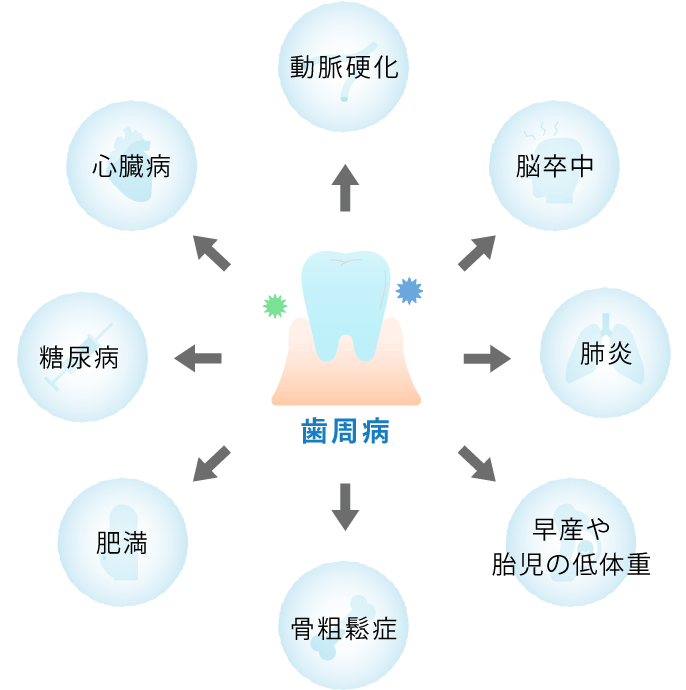 歯周病と全身の関連